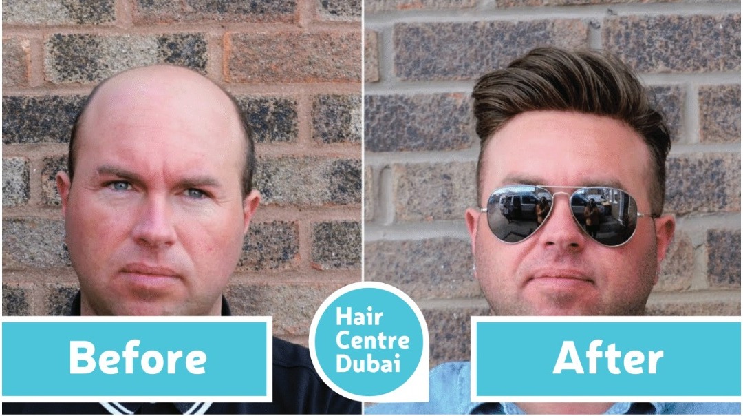 Hair Center Dubai