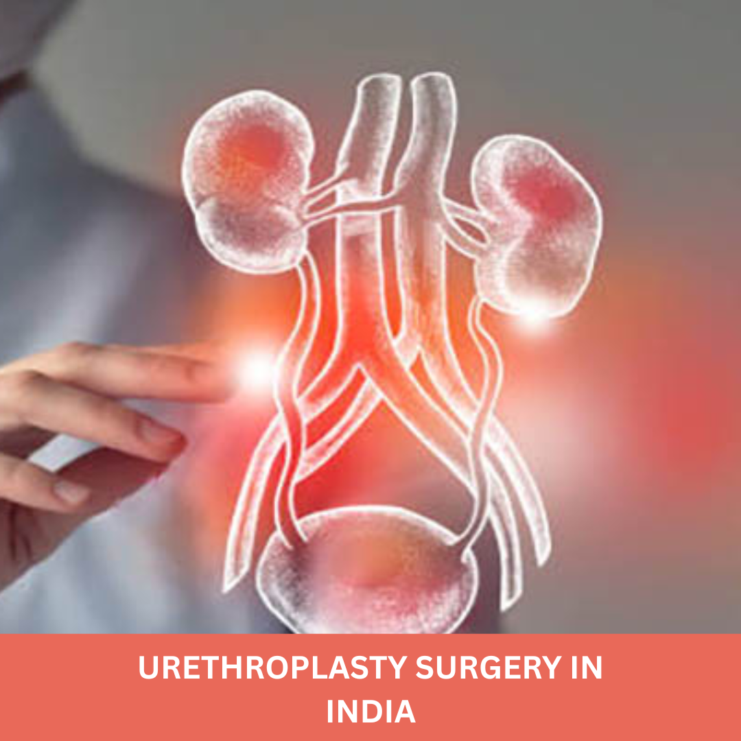 Urethroplasty Surgery in India